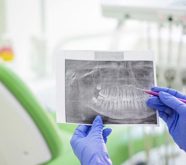Roy Periodontal Probing