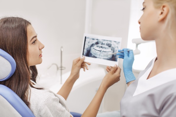 When To Consider A Root Canal Over A Tooth Extraction