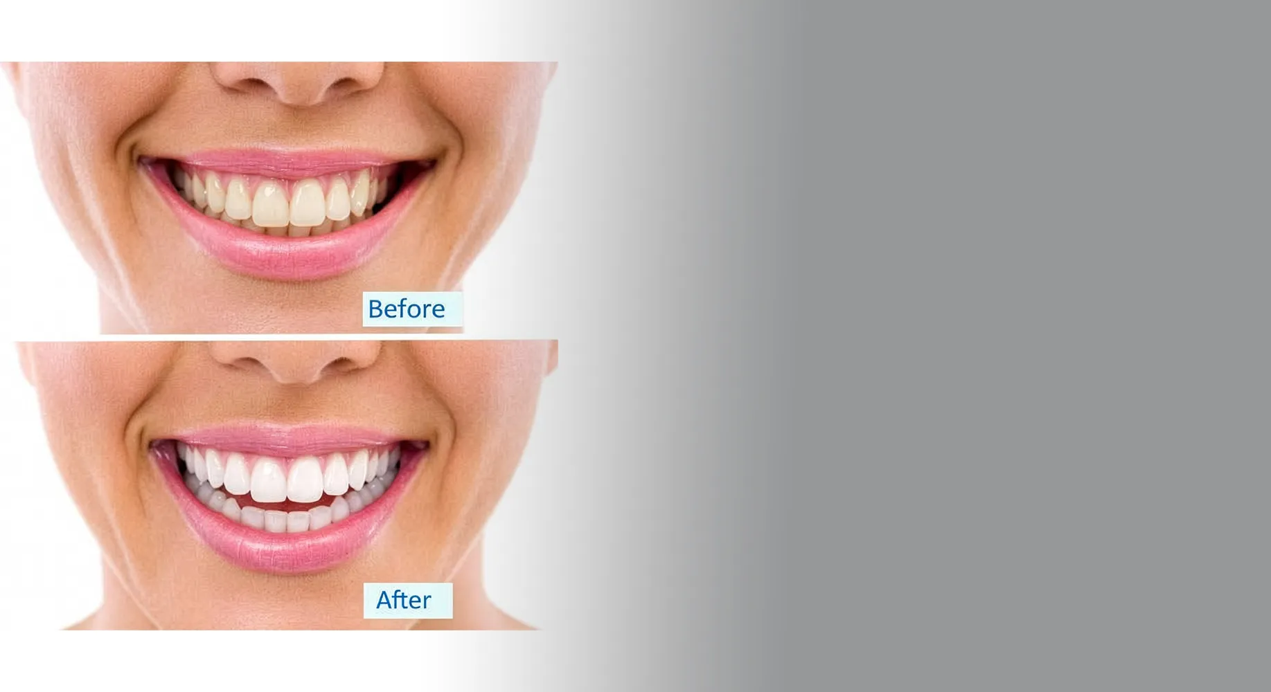 Affordable Dental Care